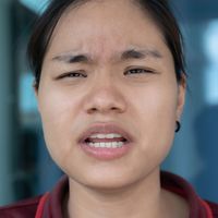 Facial expression