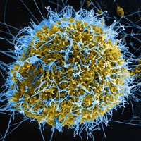 Ebola virus