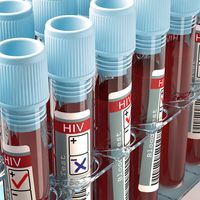 Vials of blood for HIV testing