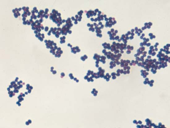 Staphylococcus aureus