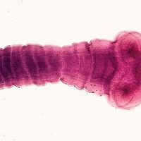 cestodiasis